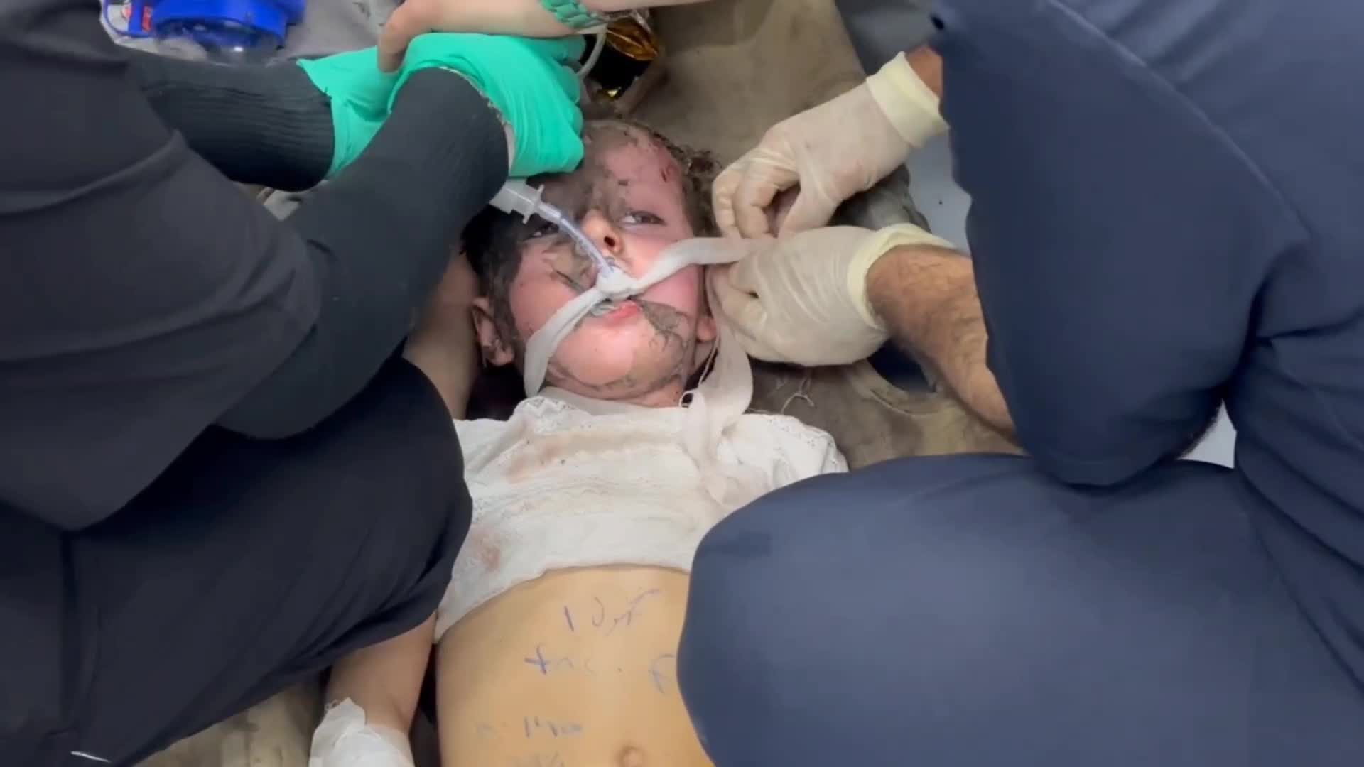 30 شهيدًا وإصابات بينها حالات خطيرة لأطفال جراء غارة جوية برفح جنوب قطاع غزة